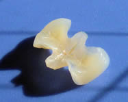 樹脂セラミック（ハイブリッド）