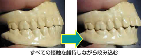 すべての接触を維持しながら咬み込む